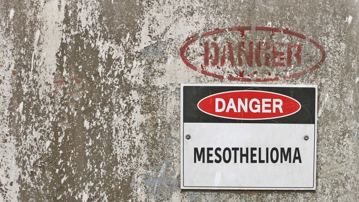 Mesothelioma Update - Andreou v S Booth Horrocks and Sons Ltd