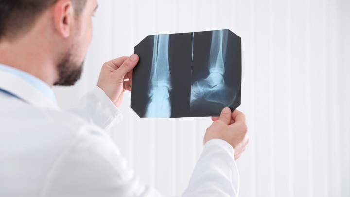 Bone xray