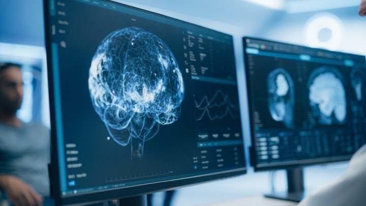brain scan 3