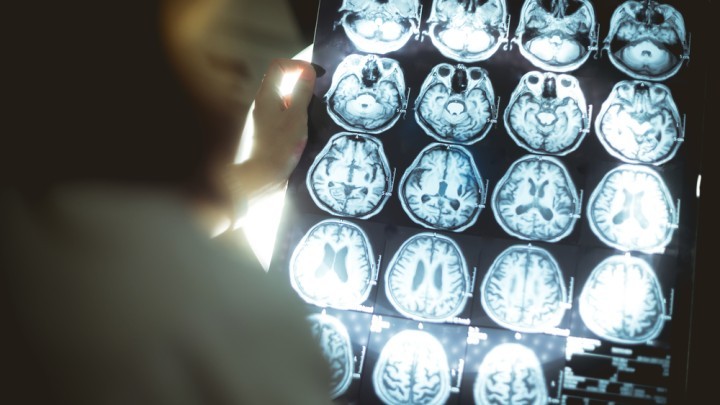 brain scan 4