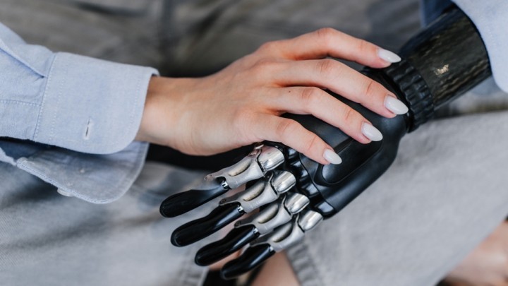 Finger Prostheses In Amputation Claims