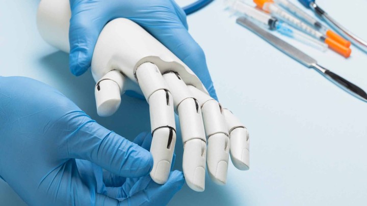 Hand and Finger Prosthetics - from Form to Function