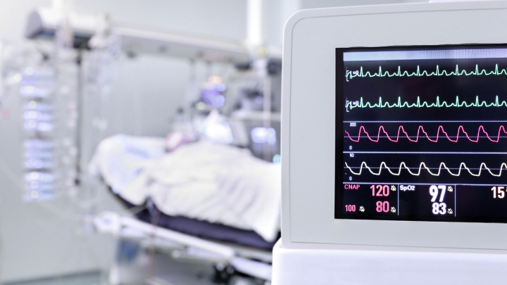 Keoghs blog: CFA funding conversion at a clients’ expense