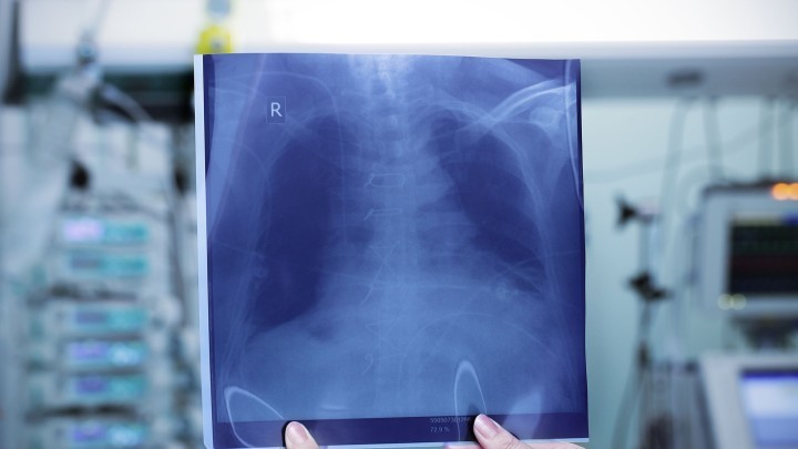 Fairclough Homes Ltd v Summers