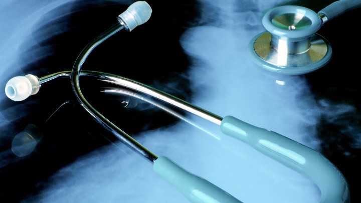 MoJ Mesothelioma consultation