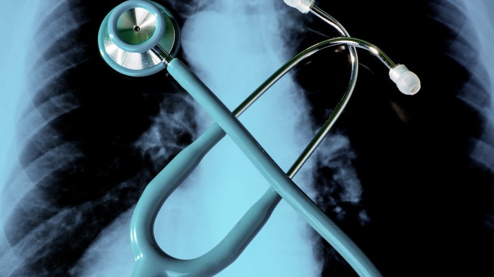 Client Alert: Asbestos Lung Cancer – Where Next? - Henneghan v Manchester Dry Docks