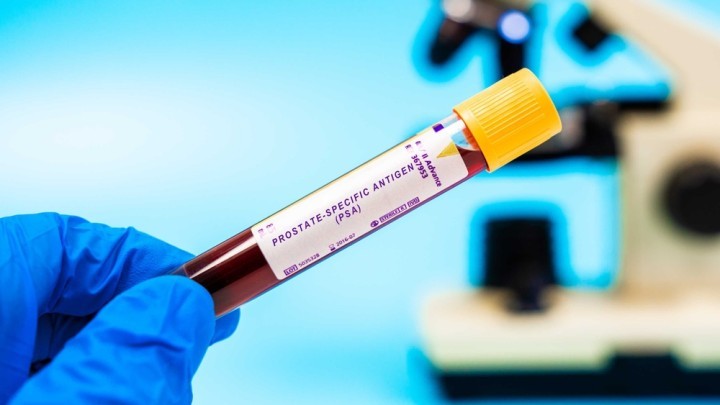 Prostate cancer