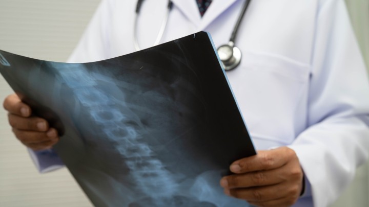 Spine Xray