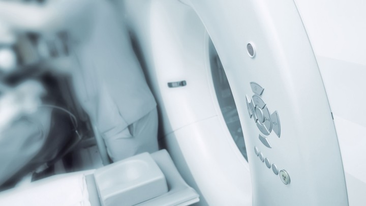 Fairchild crumble? Mesothelioma and radiotherapy