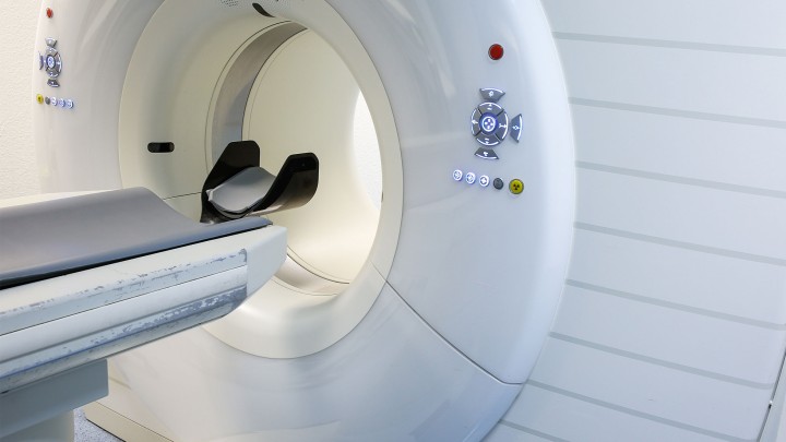 Large Loss - Subtle Brain Injury